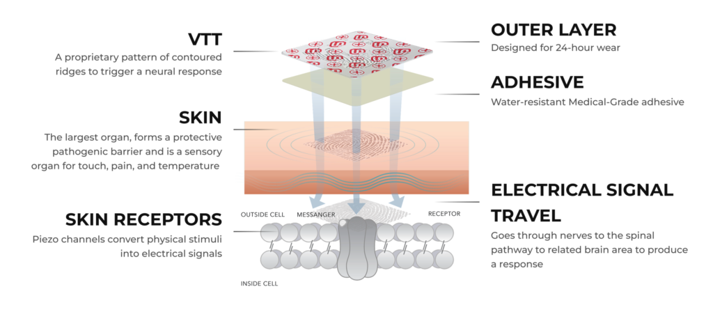 super-patch HealthPro_Diagram-scaled